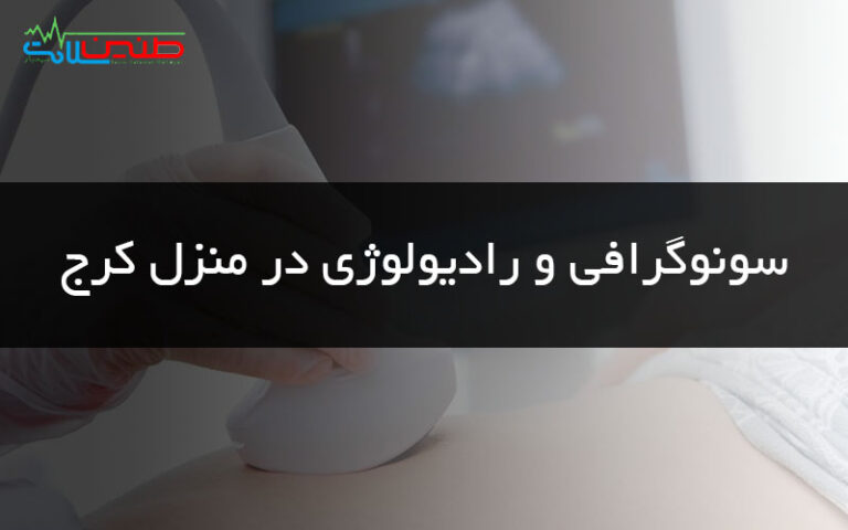 سونوگرافی و رادیولوژی در منزل کرج