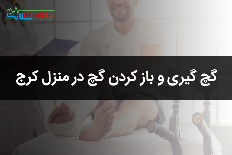 گچ گیری و باز کردن گچ در منزل کرج