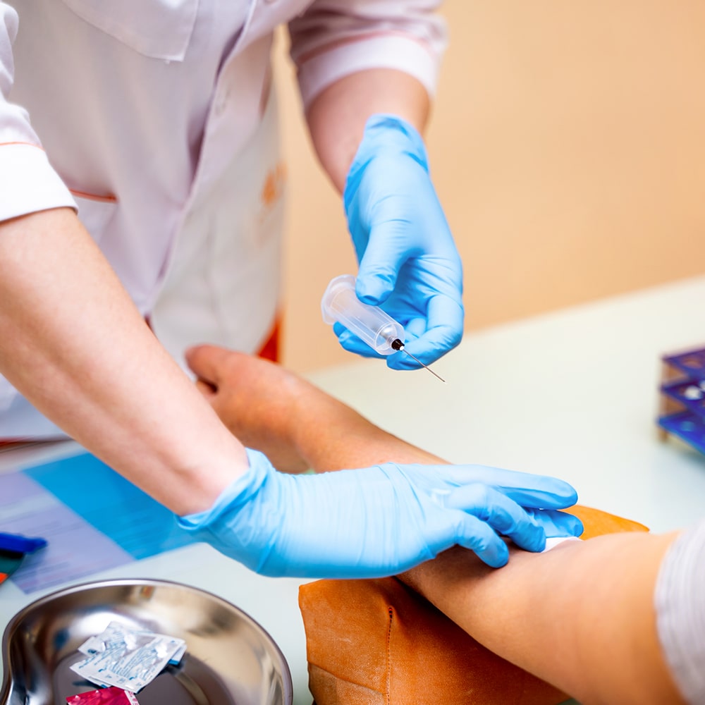 نمونهگیری آزمایش در منزل